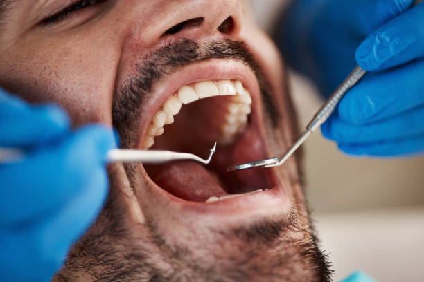 Best Emergency Treatment for Oral Infections in White Bear Lake, MN